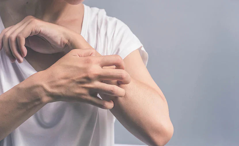 Itchy Skin in Perimenopause, Menopause and Post Menopause: Causes, Symptoms & Natural Relief