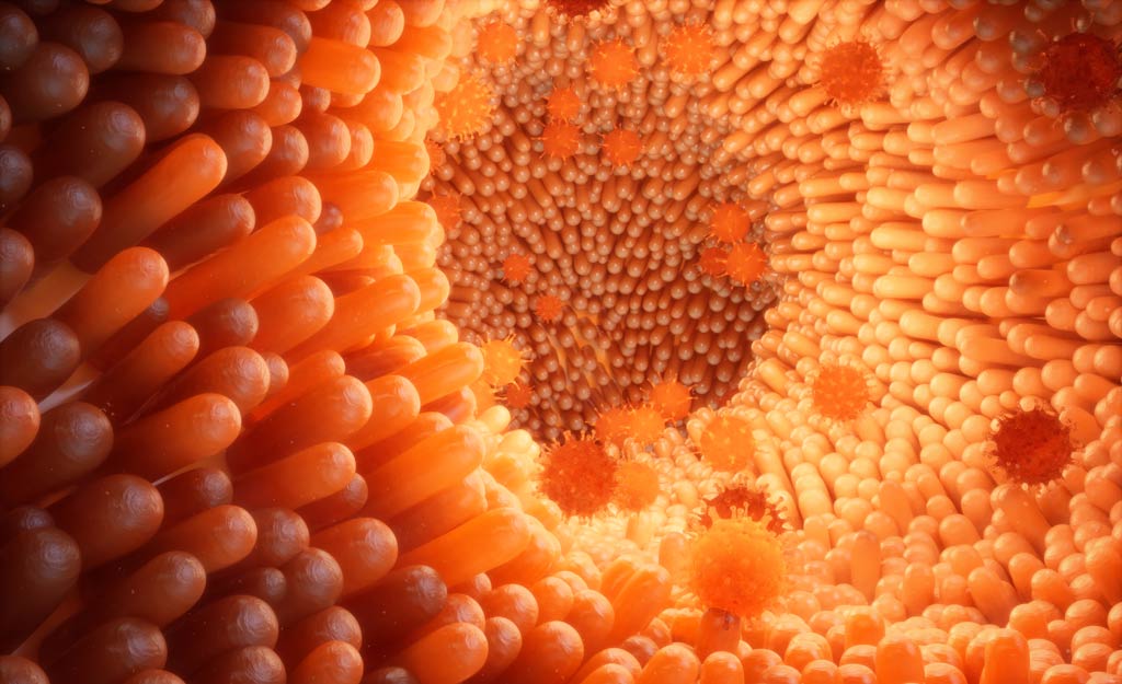 What Are Menopause Bowel Symptoms?