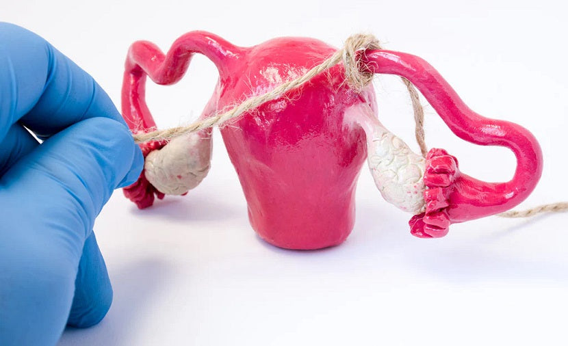 Post Tubal Ligation Syndrome