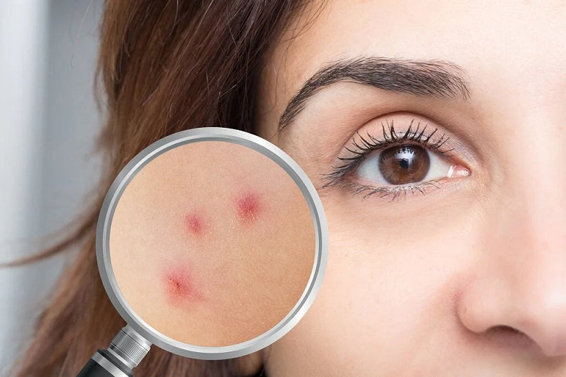 What to Expect in a Happy Skincare Consultation