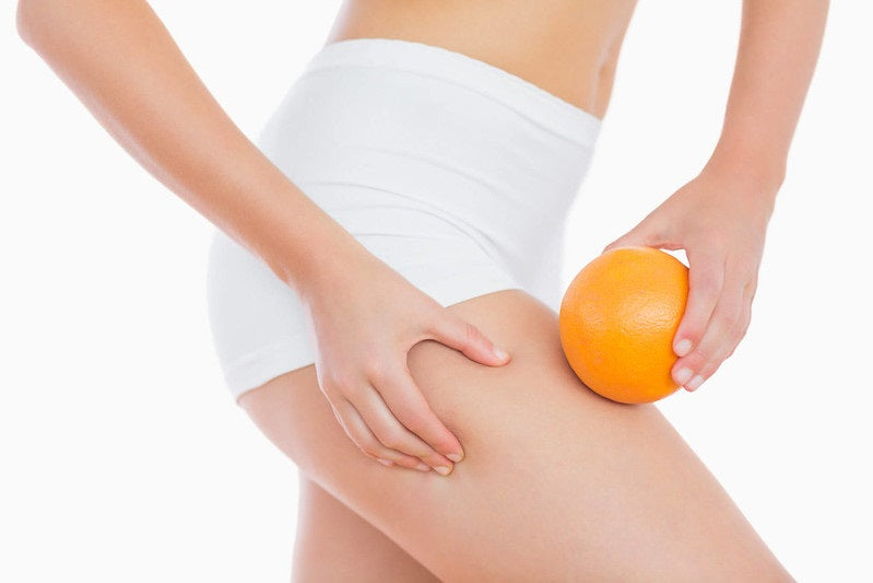 The Truth About Cellulite