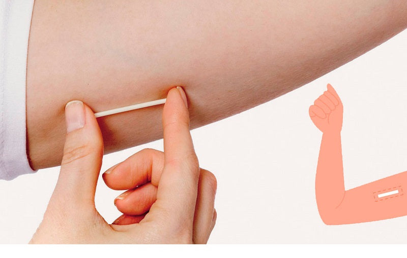 How Long After Implanon Removal Will I Get My Period? | Happy