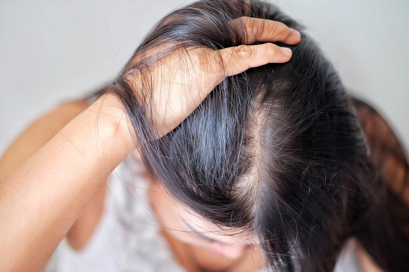 Stopping Hair Loss and Encouraging New Growth